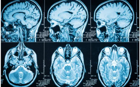 Full-Body Scans of 100,000 Britons Could Transform Global Disease Detection