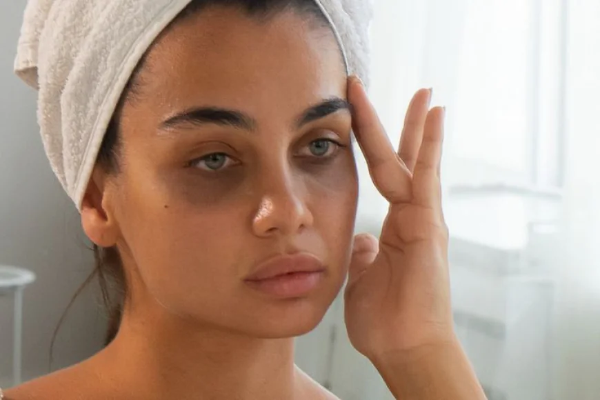 Bright Eyes Ahead: Simple Ways to Tackle Dark Circles