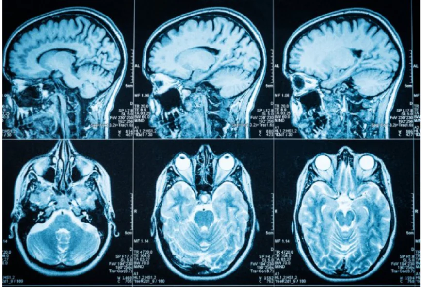 Full-Body Scans of 100,000 Britons Could Transform Global Disease Detection