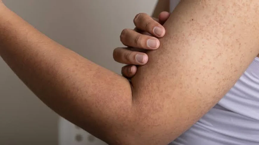 Strawberry Skin, Solved: The Secret to Silky-Smooth Confidence