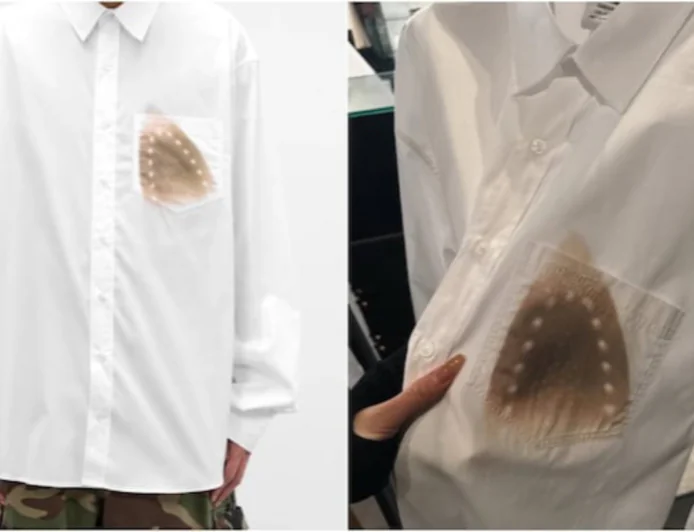 When a Burn Mark Becomes a Fashion Statement